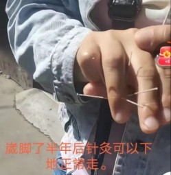 【聚焦两会重点推荐报道】著名中医针灸专家--林银财