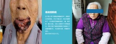 访新时代大健康科研人才 兰溪永球医院院长---宁永球