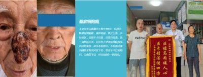 访新时代大健康科研人才 兰溪永球医院院长---宁永球