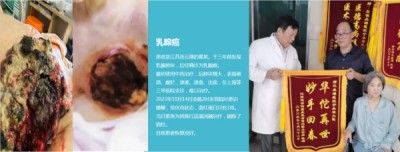 访新时代大健康科研人才 兰溪永球医院院长---宁永球