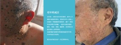 访新时代大健康科研人才 兰溪永球医院院长---宁永球