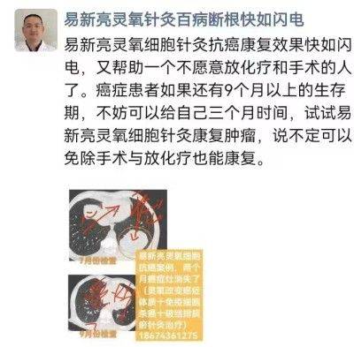 灵氧细胞百病断根疗法让三高断药风湿断根肿瘤不要化放疗的奥秘