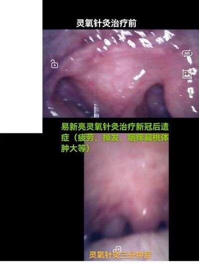 灵氧细胞百病断根疗法让三高断药风湿断根肿瘤不要化放疗的奥秘